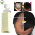 Minoxidil Powder for Hair loss